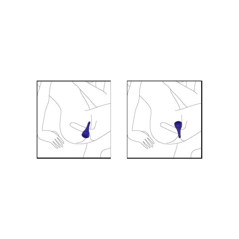 Anel Vibratório Ping Fuchsia